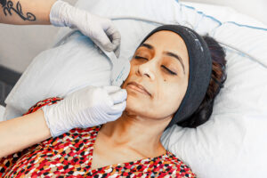 A woman reclines on a treatment table with her eyes closed as her provider applies the pads for Emface near McLean.